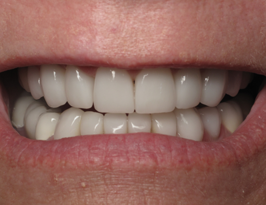 Actual patient after photo
