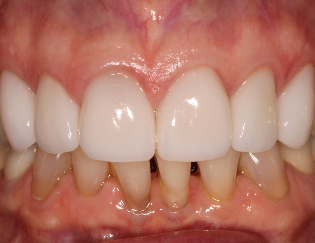 actual patient after