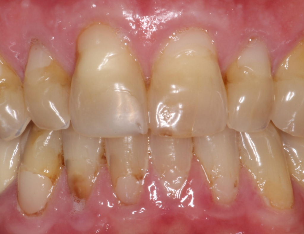 actual patient before